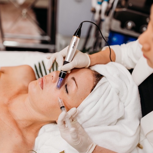 Stem cell microneedling