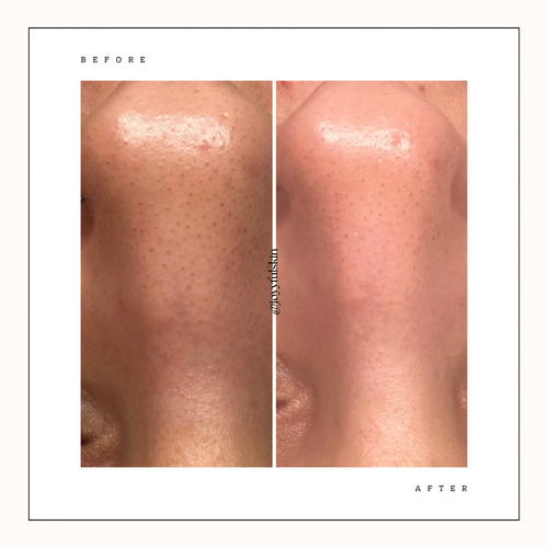 Before & After 
