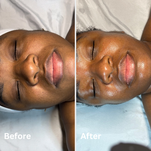 Custom facial to rejuvenate and moisturize the skin.