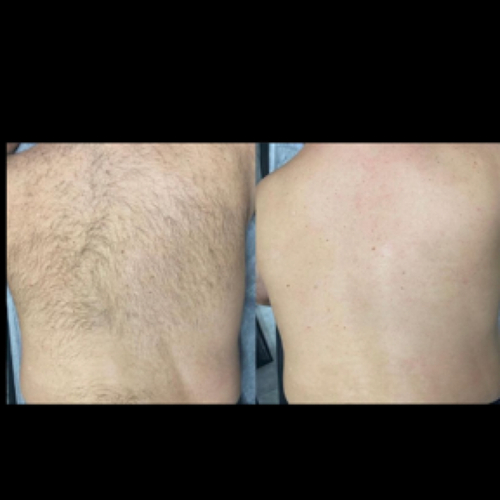 Full Back Wax 
