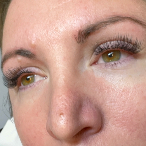2Weeks Classic Fill