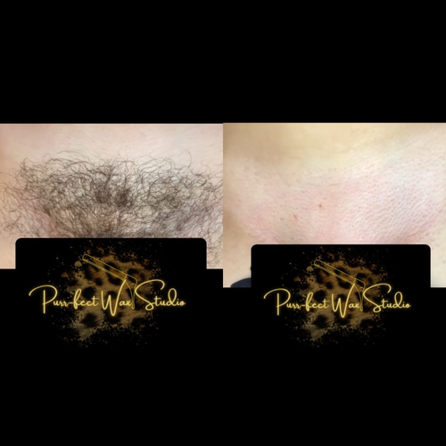 Brazilian Wax