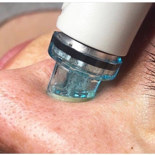 Facial 