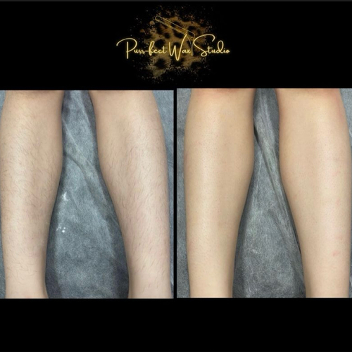 Lower Leg 
