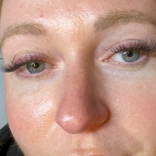 2Weeks Classic Fill