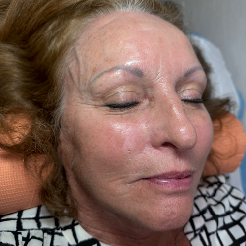 Before powder brow coverup