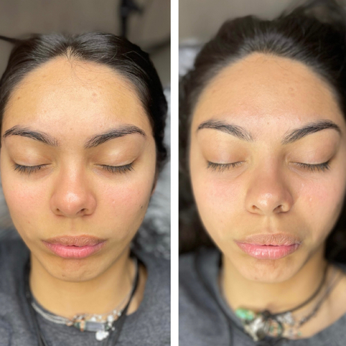 BB Glow Facial