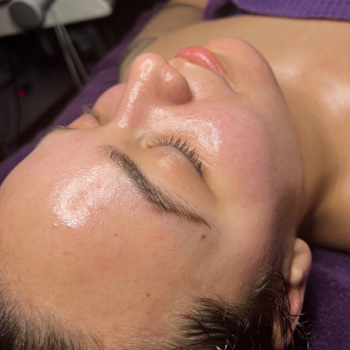 Results from The Personalized Deluxe with added Dermaplane Exfoliation 