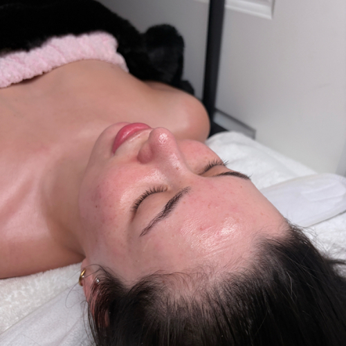 The Angel Glow Facial