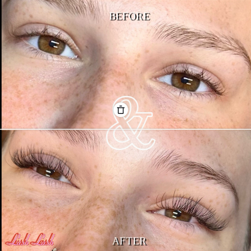 Before & After Classic Set