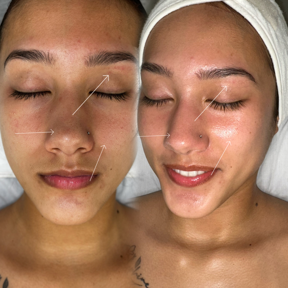 BLOOM skin+wellness