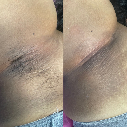 UnderArm wax