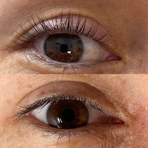 Lash lift 
