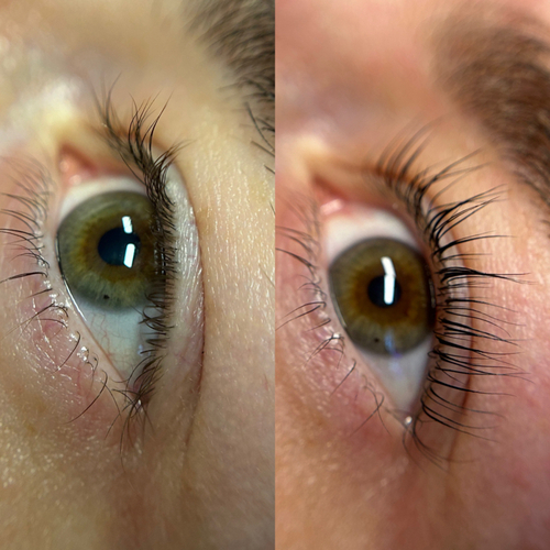 lash lift