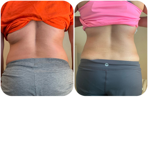 Slimming the back.