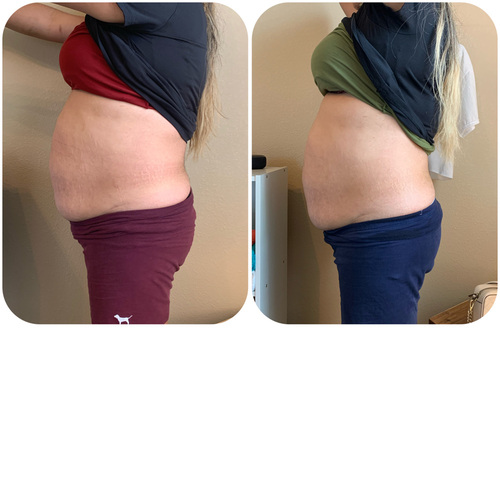 Losing the bloat.