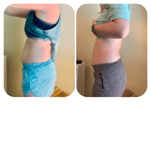  Body Contouring with Wood Therapy.