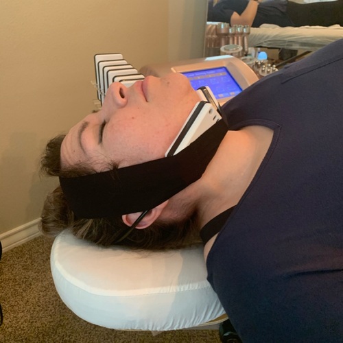 Chin Laser Lipo. Followed up with Radio Frequency.