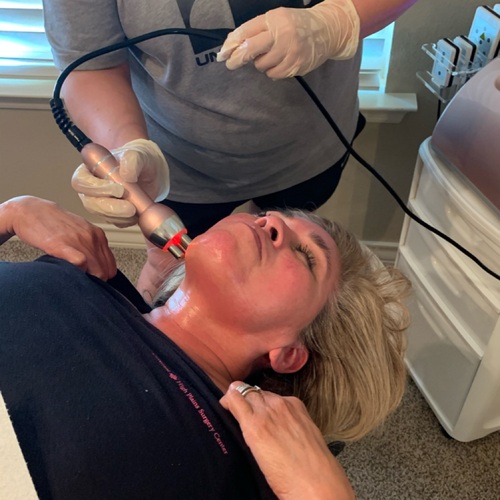 Radio Frequency Facial. Smooths out fine lines and wrinkles. Promotes Collagen.