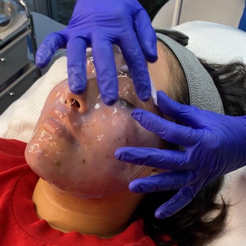 Calming lavender gelly mask after a dermaplane.