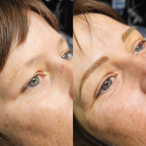 Nano combination brow 