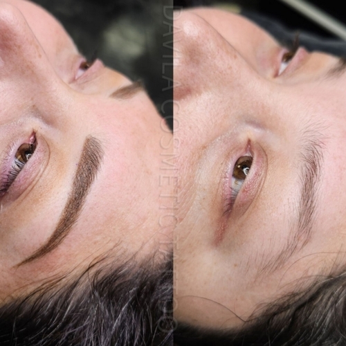 Combination Brow 