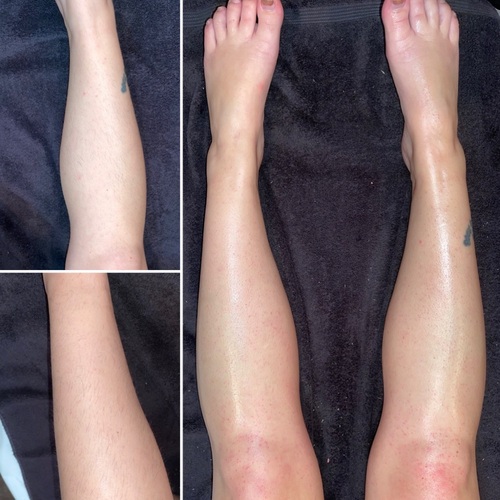 Before and after leg wax 