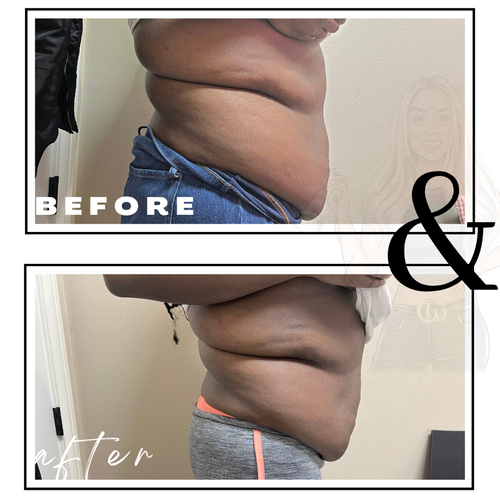 Slimming Sauna Detox - 3 sessions