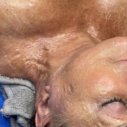 Wrinkle Relief Firming Peptide Treatment 