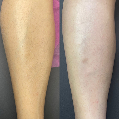 Leg Waxing 