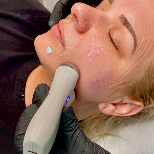 EMS FaceLift Facial