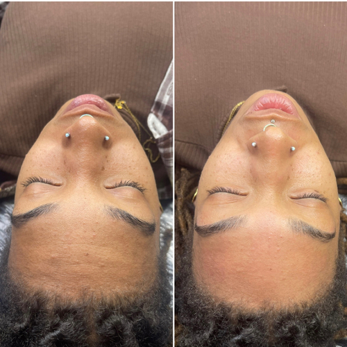 BB Glow Facial 