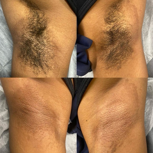 Underarm Wax
