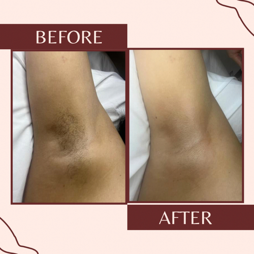 Underarm wax 
