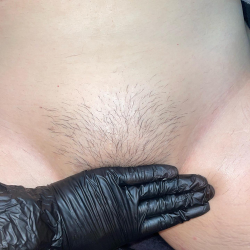 Before Brazilian Wax 
