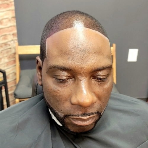 After/razor edge up