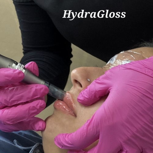 Hidracion de labios