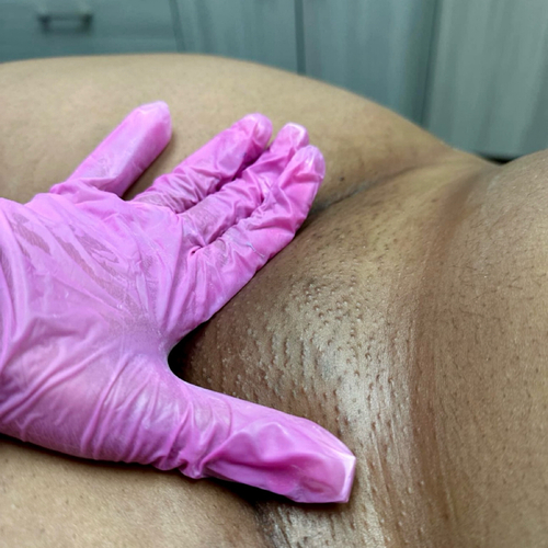 Brazilian Wax 
