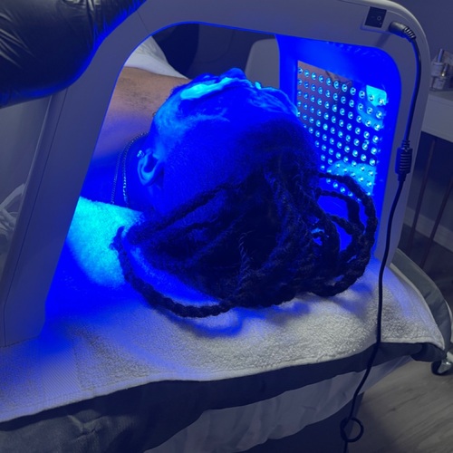 LED Blue Light Therapy for Acne 
