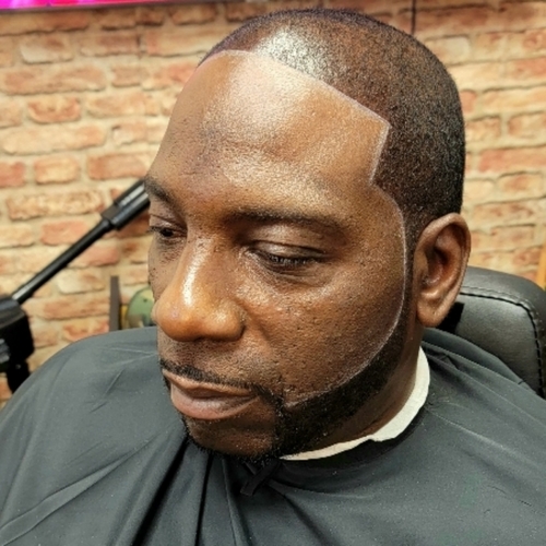 After/razor beard line 