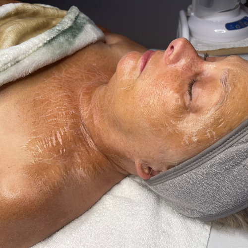 Firming Peptide Treatment 