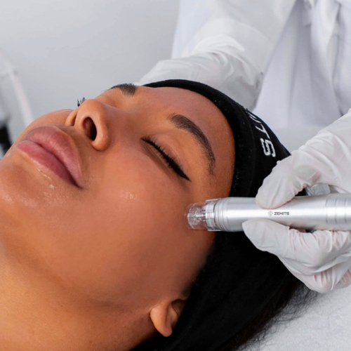 Hydrodermabrasion