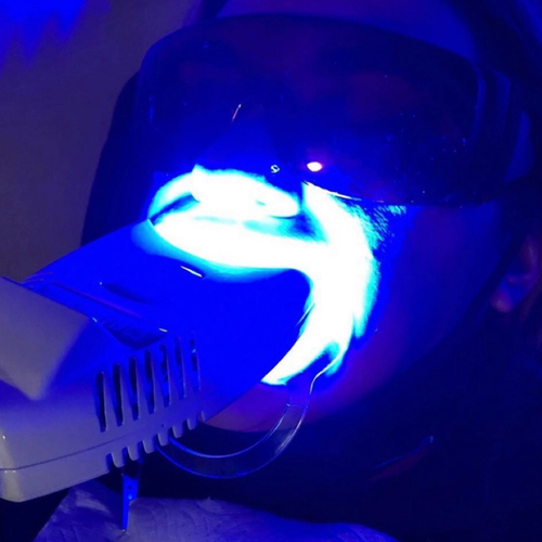 60 min Advanced Teeth Whitening Session 