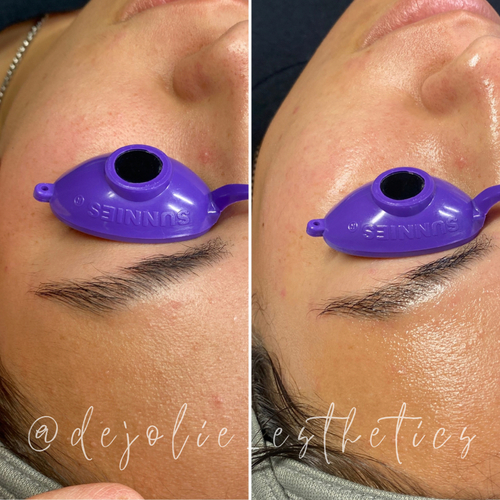 This client’s first facial, and now she’s hooked :)
