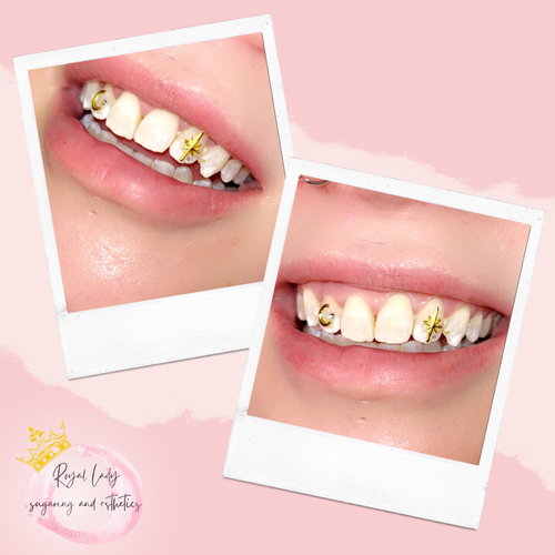 Tooth Gems
