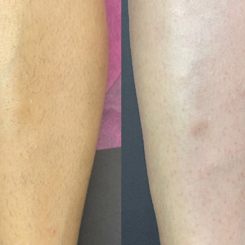 Leg Wax 