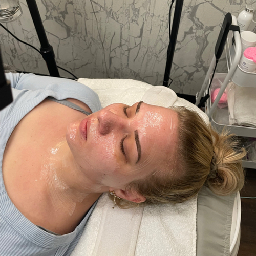 Pre microneedling numbing 