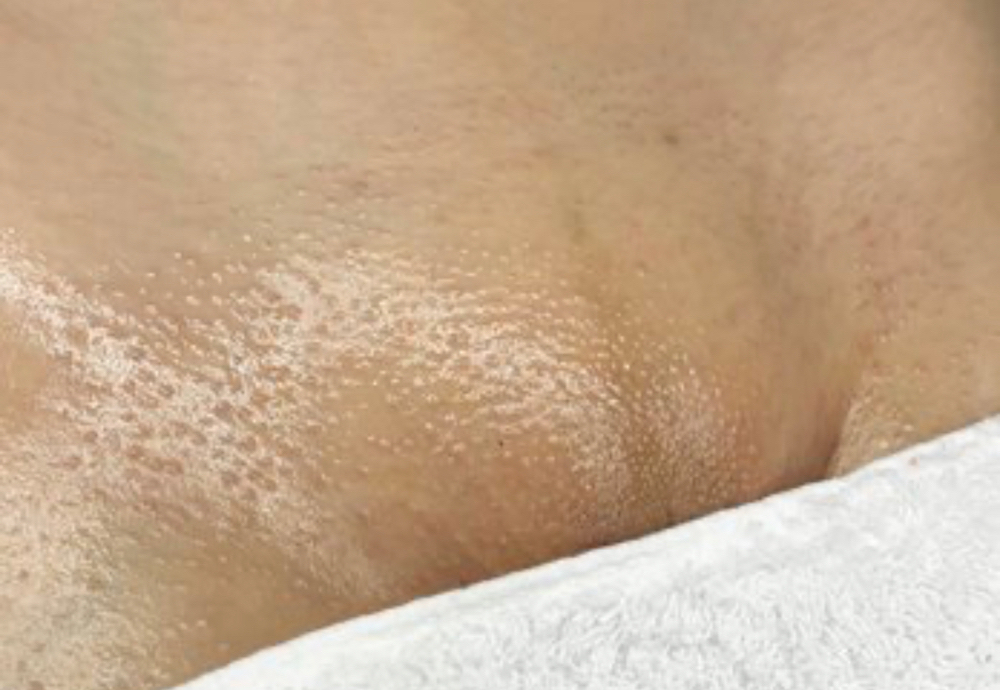 Brazilian Wax