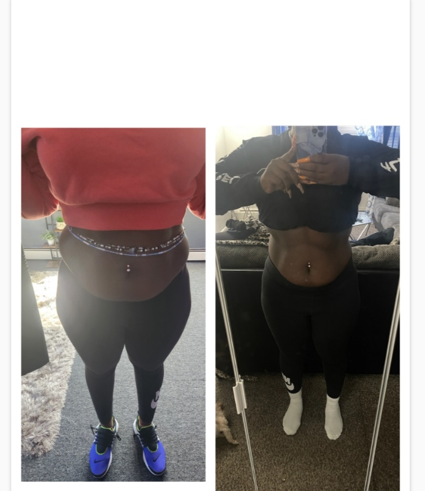 Laser Lipo Cavitation 1 Session