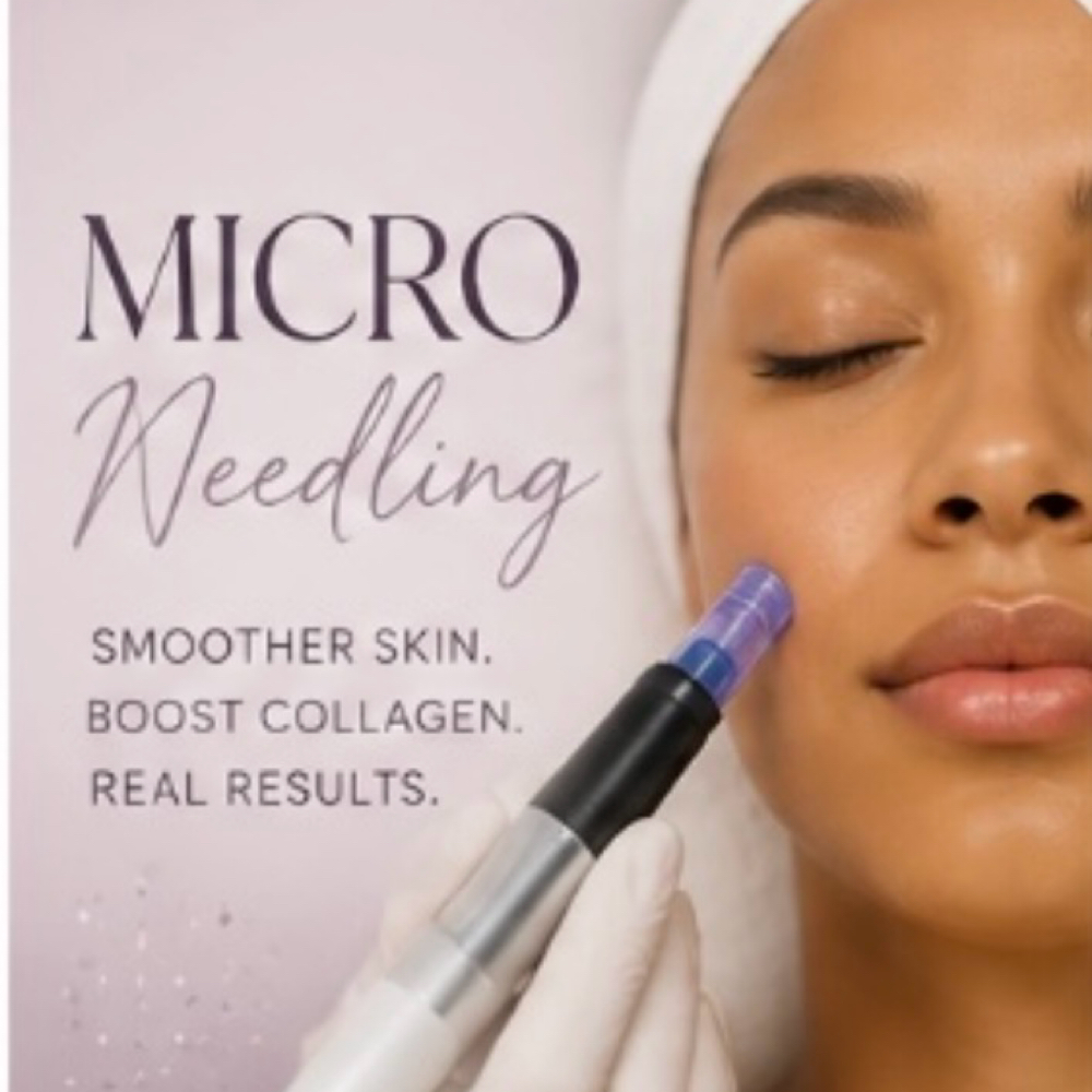 Microneedling Facial at Glow Skyyn Studio in Chicago, IL